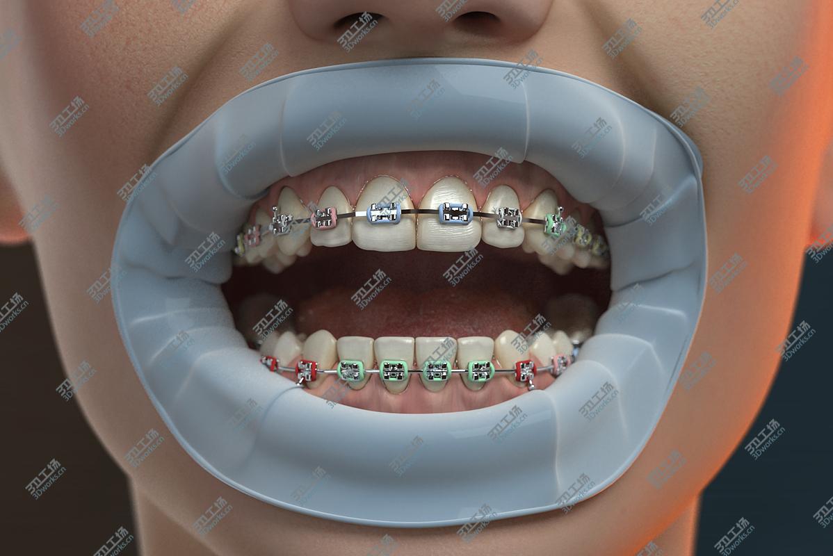 images/goods_img/2021040232/3D model Orthodontic Head (V-Ray)/4.jpg